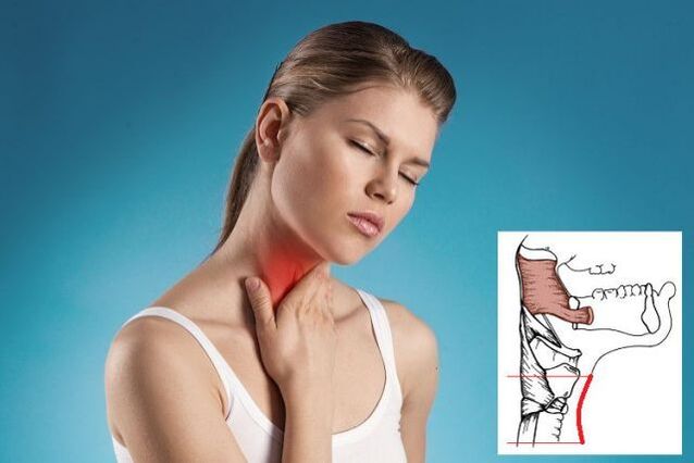 dor de garganta con osteocondrose cervical