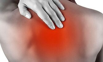 Os principais síntomas da osteocondrose cervical