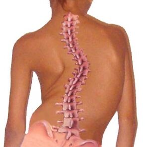 A curvatura da columna vertebral leva á osteocondrose